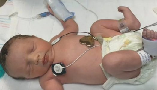 Lynlee "nasceu pela segunda vez" em 6 de junho, através de uma cesariana feita próximo do fim da gravidez. Ela veio ao mundo saudável e pesando 2,4 kg. Foto: Youtube/Reprodução